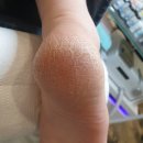 푸스케어대전신탄진점 | 대전 둔산동 발각질 관리 거칠어진 발뒤꿈치 독일식 케어하세요
