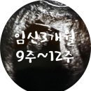 비오엔지 | [임신3개월 9주~12주] 임신 3개월 증상 / 튼살크림