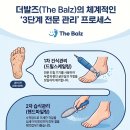 더발즈