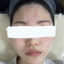 이룸한의원 | 청주피부관리 이룸에스테틱 트러블케어 수분충전 대만족한 솔직후기!!