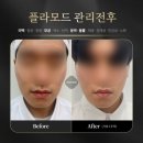 로로코스메틱 이미지