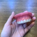 참고운미소치과교정과치과의원 | 치아교정 고민하다 미소그리다치과에서 첫 상담받아본 후기!