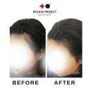 리게인프로젝트 일산 이미지