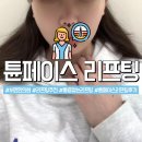 해뜨는한의원 | 부산 서면 한의원 튠페이스 리프팅 통증 및 후기 1주차 6만줄