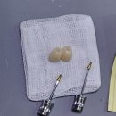 크라운덴트 | *우루덴트SA 임상리뷰20*세 남성 상악 #23–24 브릿지 케이스｜우루덴트 SA로 완성한 보철