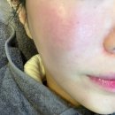 청담에이스의원 이미지