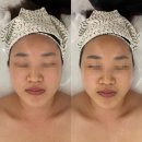 신도림피부관리 프리미엄 산소관리 인트라슈티컬스후기