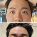 미정헤어라인
