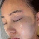 세븐일레븐 울산삼산웨딩점 | 울산승모근관리 살롱드비숑삼산점 드레스핏 케어 받은 후기