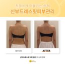 피에이치디피부과의원 | 발흥민으로 불리는 압구정에스테틱, 예비신부피부관리가 다른 이유는?