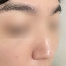 버블헤드 | 남자 블랙헤드, 차앤박 버블 노즈 코팩 이틀 연속 써보니 솔직 후기