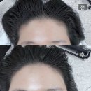 인천 부천 헤어라인문신 정리 미작뷰티 방문 솔직 후기 추천