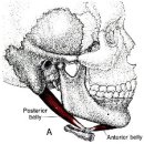 이복근(digastric muscle-pseudosternocleidomastoid pain) 이미지