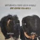 박영구 | 김포 잡티제거 후기 미작뷰티검단점