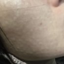 심외과의원 | 평택역피부과, 속건조·탄력 저하에 어떤 시술이 맞을까 스킨부스터 정리