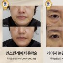 센텀수피부과 네이버블로그
