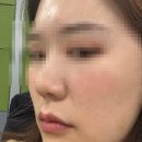 네오의원 | 30대뷰티일상｜ 온다리프팅, 네오빔레이저, 리쥬란