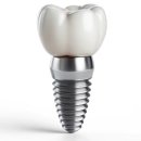 2080치과의원 | 부천시 소사구 임플란트 치과 잘하는 곳, 가격 비용 싼 곳 BEST10 추천