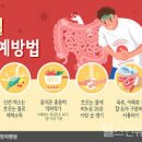 장염에 걸렸을 때 원인별 증상 차이점과 대처 방법 이미지