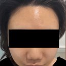 베이스메디칼 | [경기/남양주 에스테틱] 다산피부관리 스파힐미 후기 가격 주차 예약