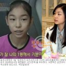 중국서 ‘김연아 성형의혹’ 확산…언론까지 가세 ‘급물살’ 이미지