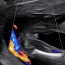 봄빛산부인과의원 | 안양 삼성제일산부인과 임신검진 솔직후기