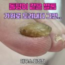 레푸스 화정점 이미지