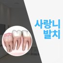 시흥공단치과의원 | 시흥대야역치과 잘하는곳 씹을 때 한쪽이 자주 불편하다면