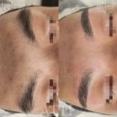 잘생겨지고 싶은 남자라면, 아띠에스테틱으로!