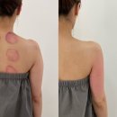 10일다이어트전문샵 | 💍 내포 예비신부관리, 내포에서 가장 많은 예비신부가 찾는 샵에서 추천하는 필수 3가지!