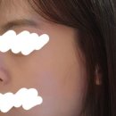 릴리성형외과 이미지