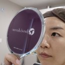 속편한김내과의원 | 압구정 리프팅 리쥬란 + 쥬베룩 후기 , 속건조 피부 개선 효과는?