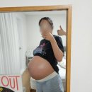 제왕절개 출산 후기 (리베르여성병원)