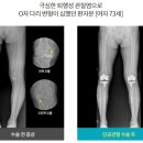 마디세상병원 네이버블로그