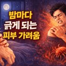 이니스프리동래점 | 밤마다 긁게 되는 피부 가려움, 혹시 ‘소양증’인가요? │ 원인부터 치료까지 따뜻하게 정리한 완전...