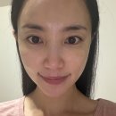 빵블리;내아침을부탁해 | [ 신논현역 피부과 ] 스킨부스터 모공 리투오 6cc 내돈내산 후기