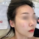 테크닉오토 | 마산 피부관리_드웰에스테틱 / 탄력에 좋은 더쎄라 스템셀 리턴 관리 내돈내산 후기