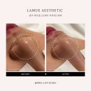라뮤에스테틱 | 블랙헤드 제거 후기 - 광주 피부관리 라뮤에스테틱