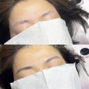 명지카클리닉 네이버블로그