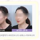리팅대구