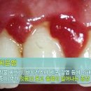 덴탈프렌즈 이미지