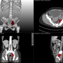 엠에스병원 이미지