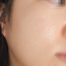 상하3통 | 라로슈포제 재생크림 시카밤 3통째 내돈내산 여드름 레이저 후 찐후기