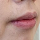 어썸미beauty