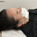 선헤어라인 이미지