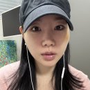 울쎄라 300샷 두 달 후기 (갈수록 효과 좋을까? 진짜?)