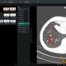 IEC 소프트 이미지
