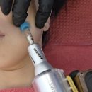 리젯네일 | 구리피부관리 루미인뷰티에서 페어리젯으로 리프팅