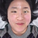 좋은피부 | 실력좋은 마곡에스테틱 루미에르 피부관리 리프팅 솔직후기