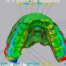 샤인치과기공소 이미지